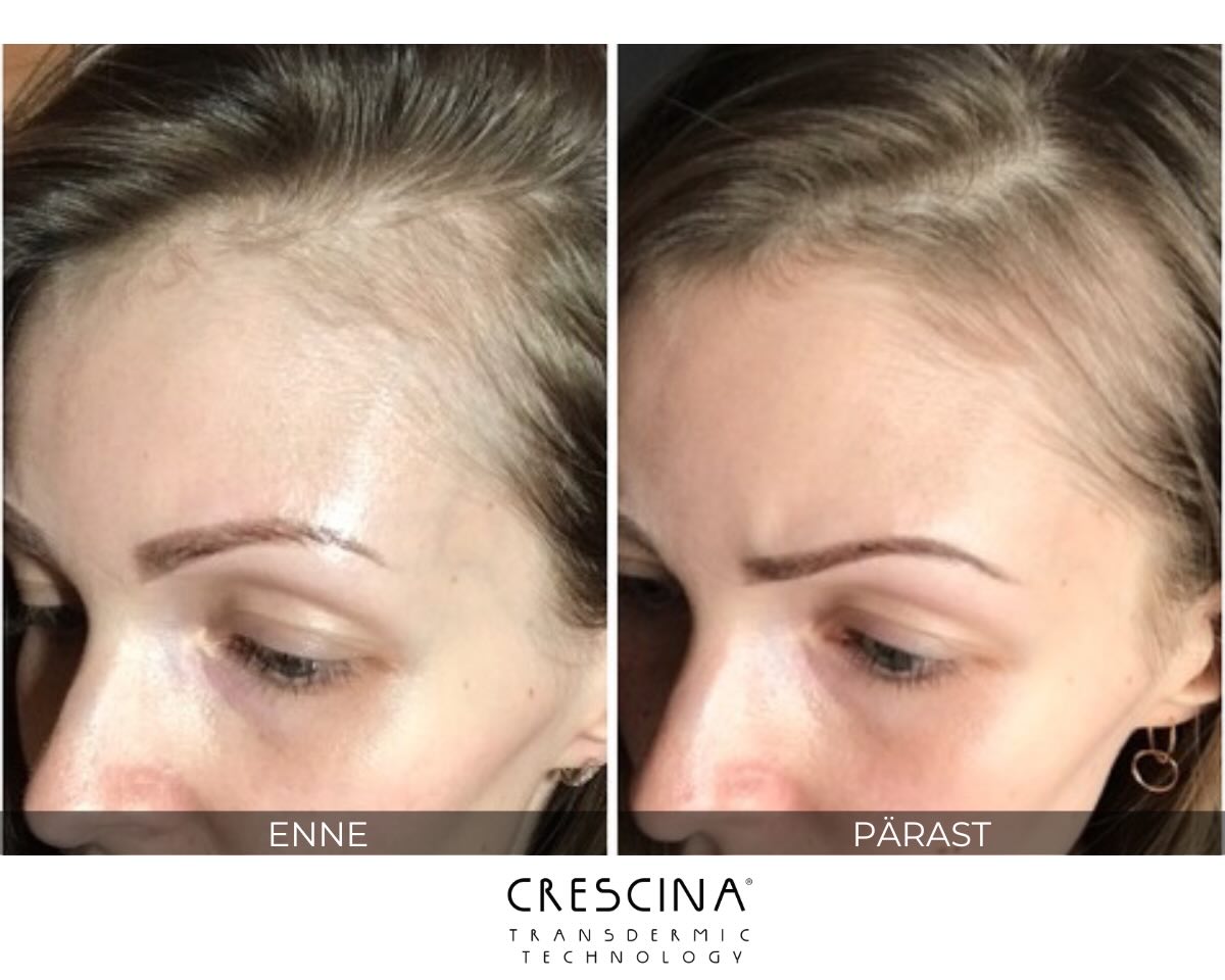 crescina-enne-parast crescina-enne-parast