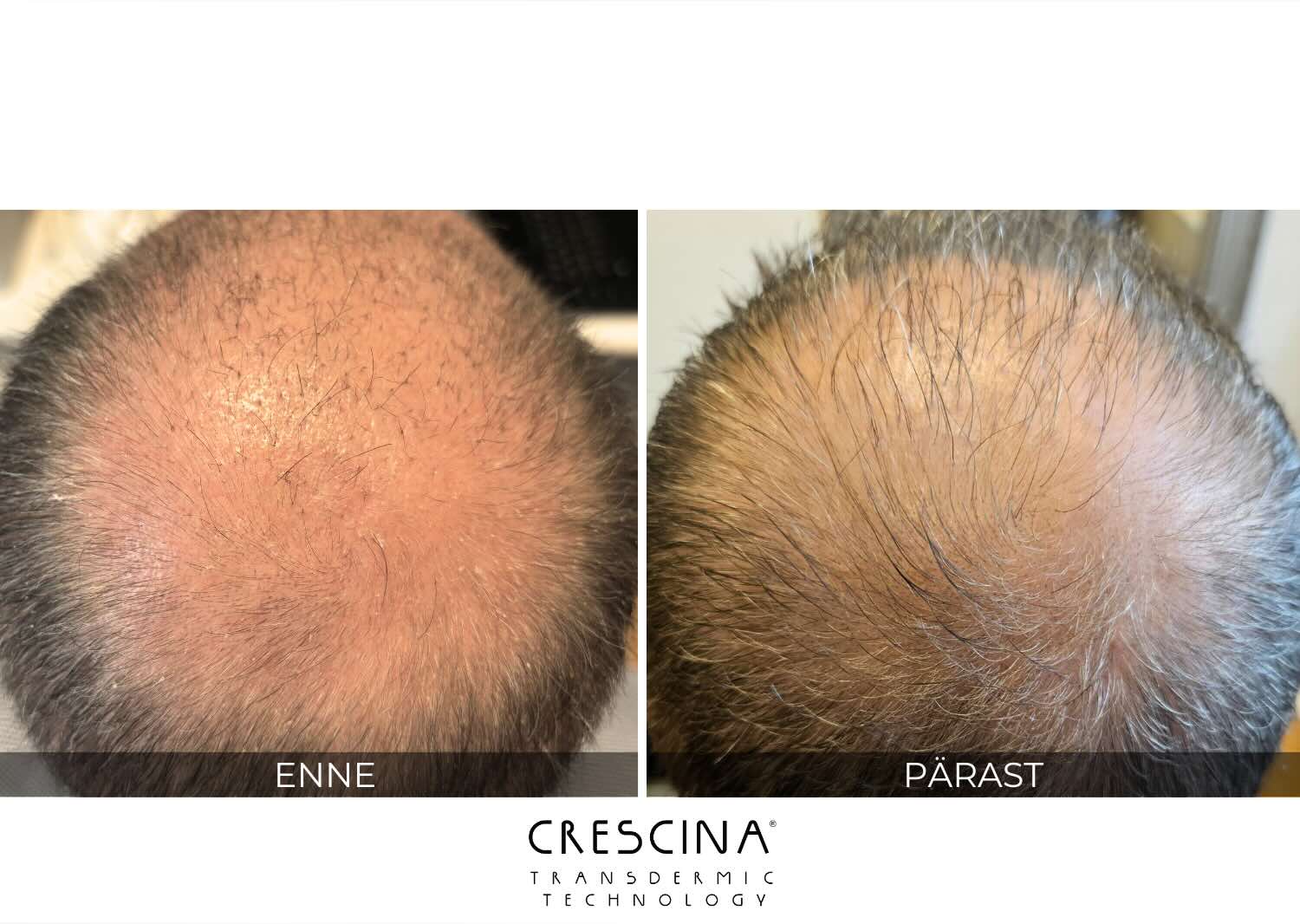 crescina-mehed-tulemus crescina-mehed-tulemus