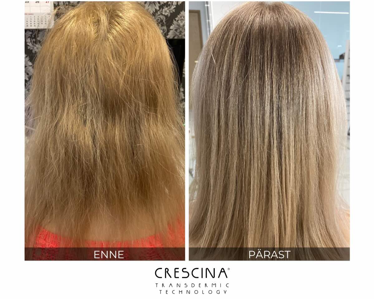 tihedamad-juuksed-crescina-enne-parast.jpg tihedamad-juuksed-crescina-enne-parast.jpg