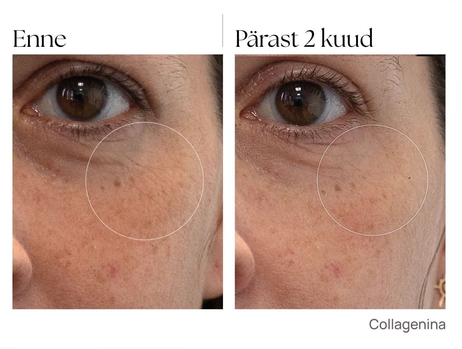 collagenina_seerum_tulemused_enne_parast collagenina_seerum_tulemused_enne_parast