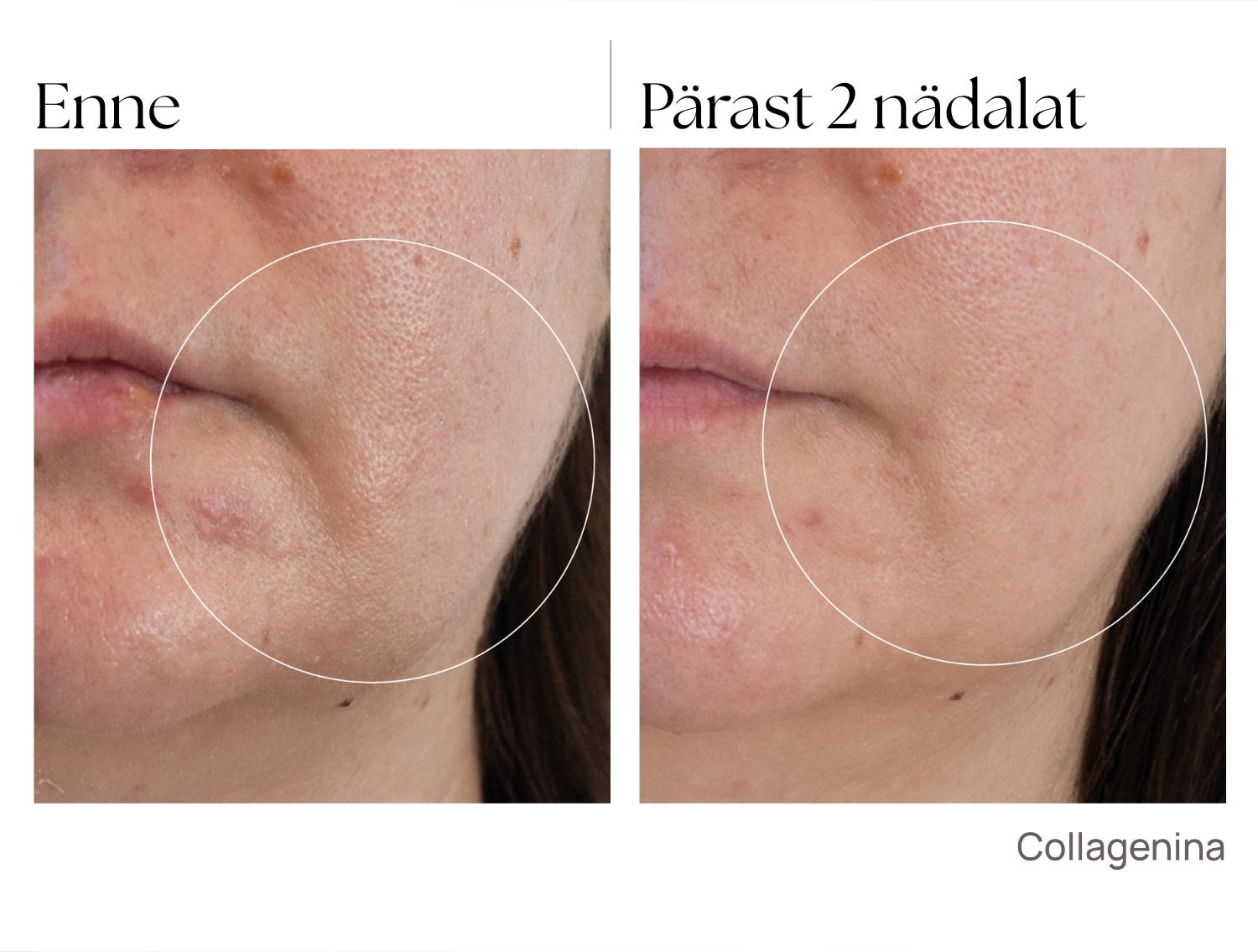 collagenina_tulemused_intensiivhooldus collagenina_tulemused_intensiivhooldus