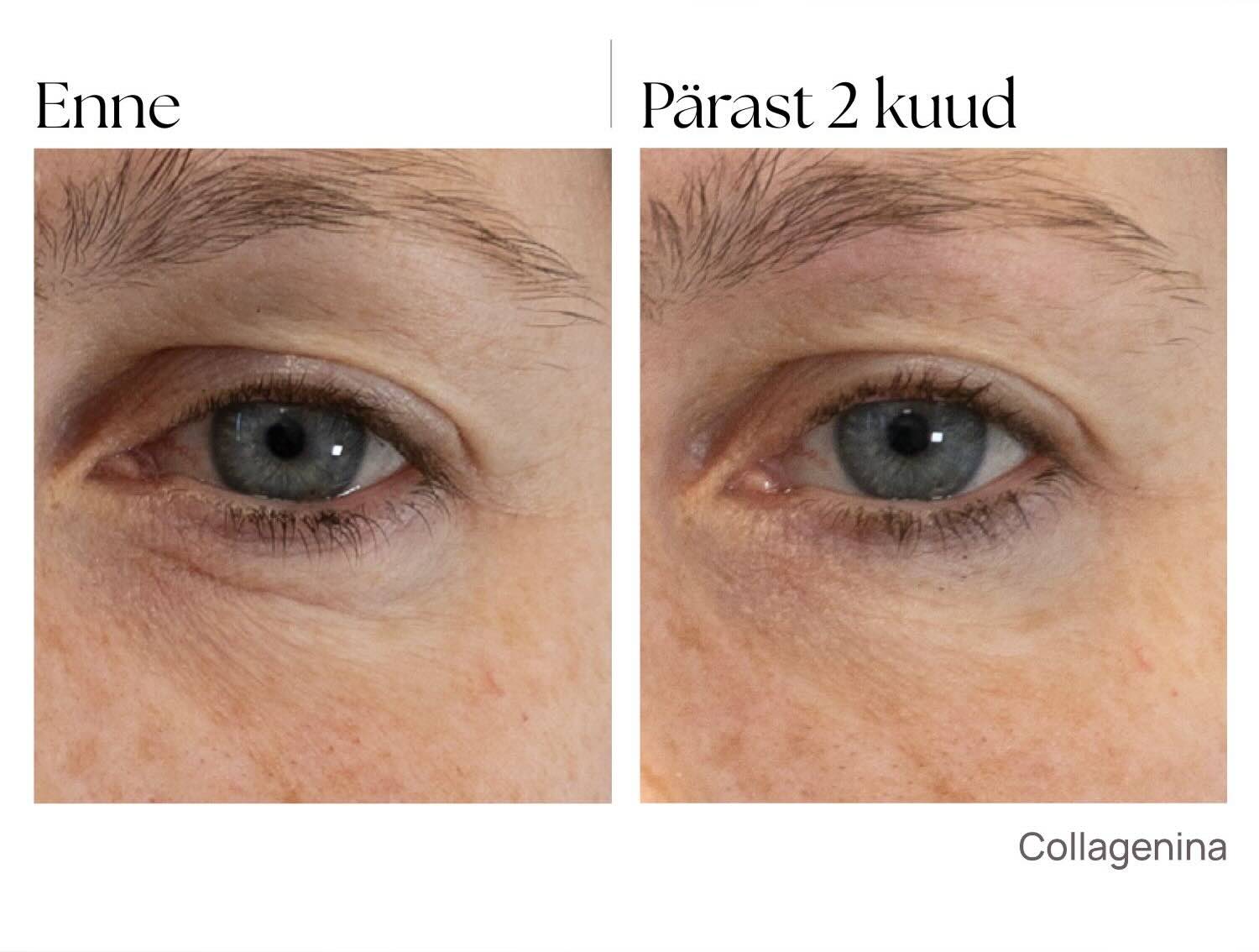 enne_parast_collagenina_seerum_kollageeniga enne_parast_collagenina_seerum_kollageeniga